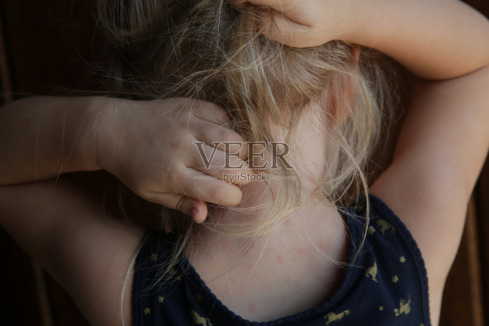 夏天皮疹。常见的幼儿皮疹或红点过敏反应。照片摄影图片