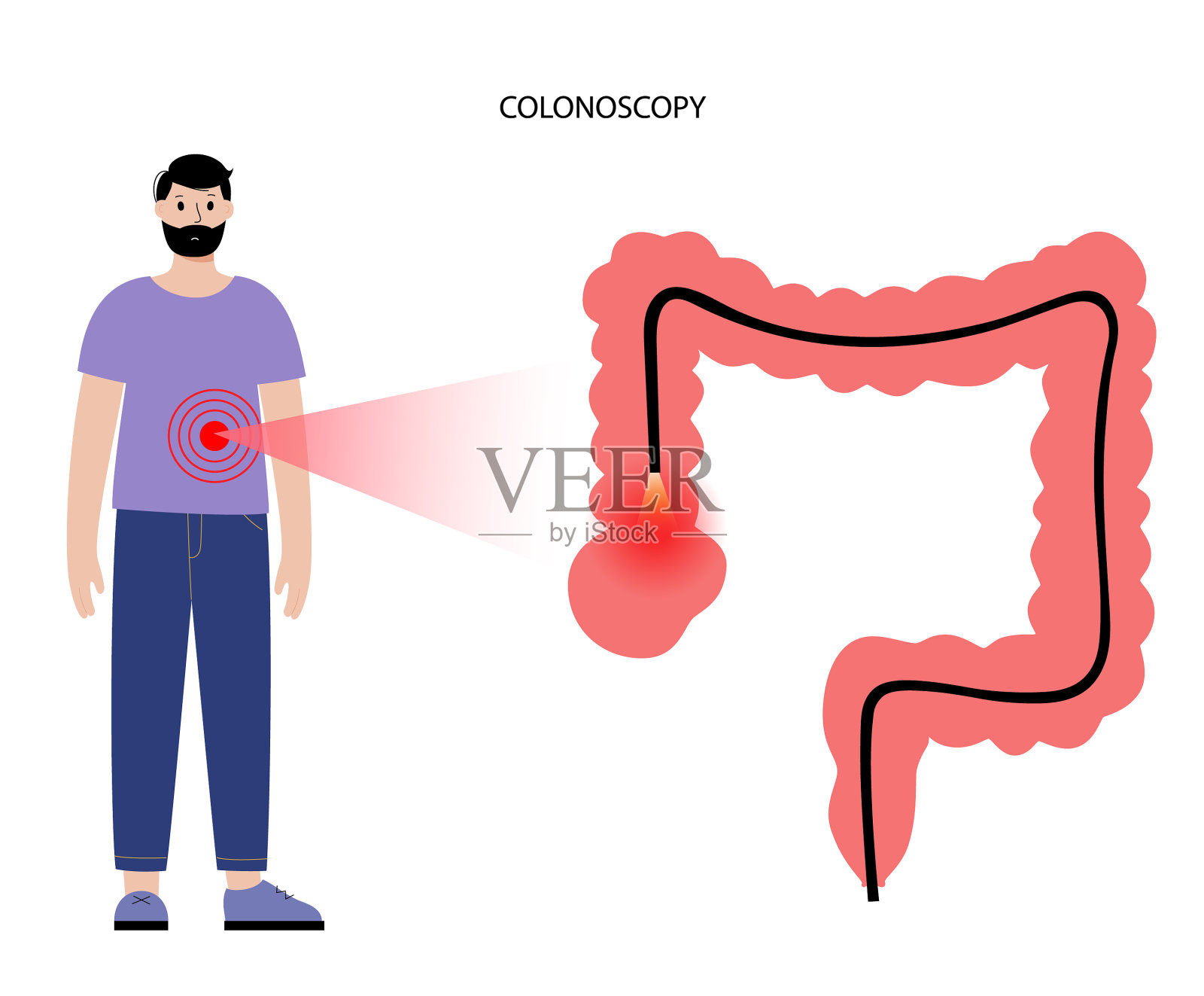图14-3 结肠袋X线造影-腹部外科临床解剖学-医学